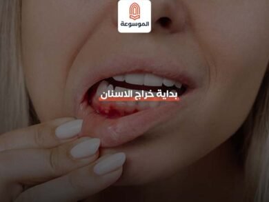 بداية خراج الاسنان