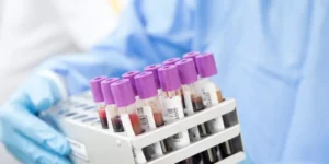 الفرق بين CBC وتحاليل الدم الأخرى