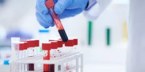 أهمية تحليل CBC