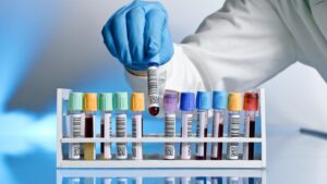 طرق خفض مستويات LDH المرتفعة