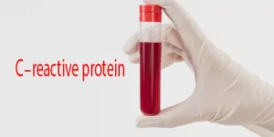 العوامل المؤثرة على نتائج CRP