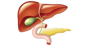 علاج حصوات المرارة بدون جراحة