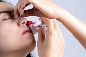 العلاجات المنزلية لنزيف الأنف