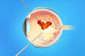 الشبكية: كيف تعمل؟