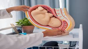 تأثير وضعية الجنين على الولادة