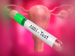 نصائح لتحسين نتائج تحليل AMH