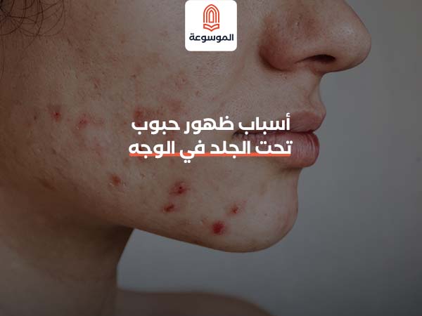 أسباب ظهور حبوب تحت الجلد في الوجه
