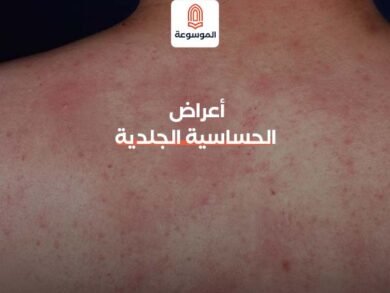 أعراض الحساسية الجلدية