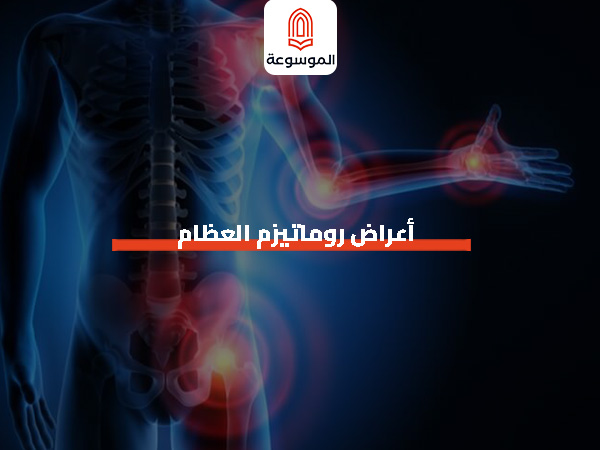 أعراض روماتيزم العظام