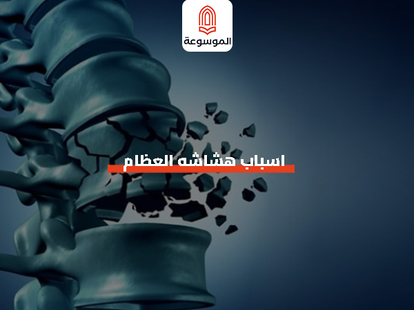 اسباب هشاشه العظام