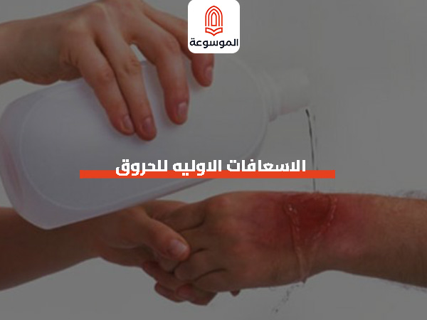 الاسعافات الاوليه للحروق