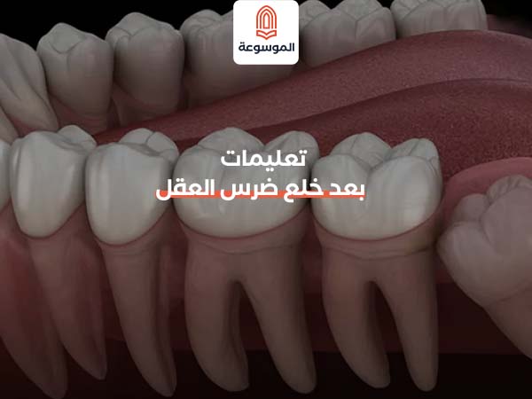 تعليمات بعد خلع ضرس العقل