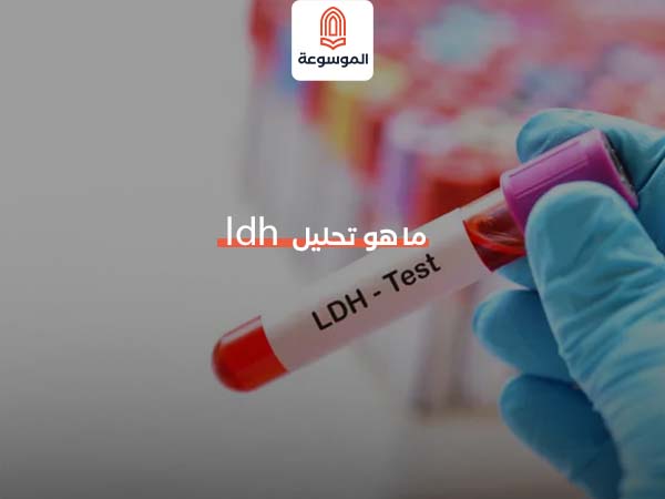 ما هو تحليل LDH