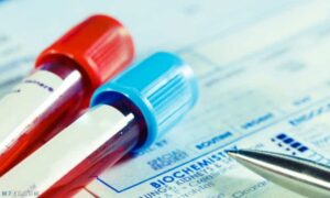 أهمية تحليل CRP في تشخيص الأمراض