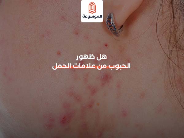 هل ظهور الحبوب من علامات الحمل