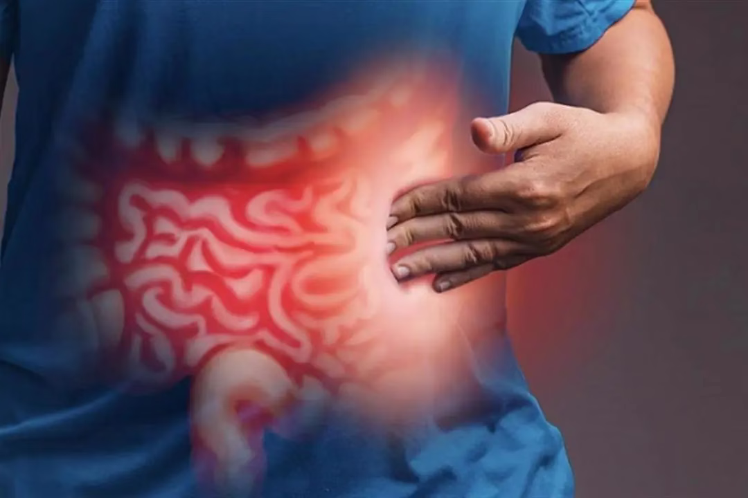 طرق علاج مرض الكرونز