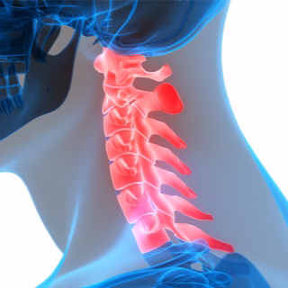 كيفية الحفاظ على صحة الفقرات العنقية