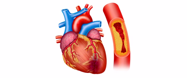 كم عدد شرايين القلب