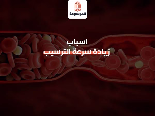 اسباب زيادة سرعة الترسيب