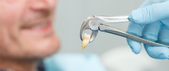 ما يعنيه خلع الضرس في المنام