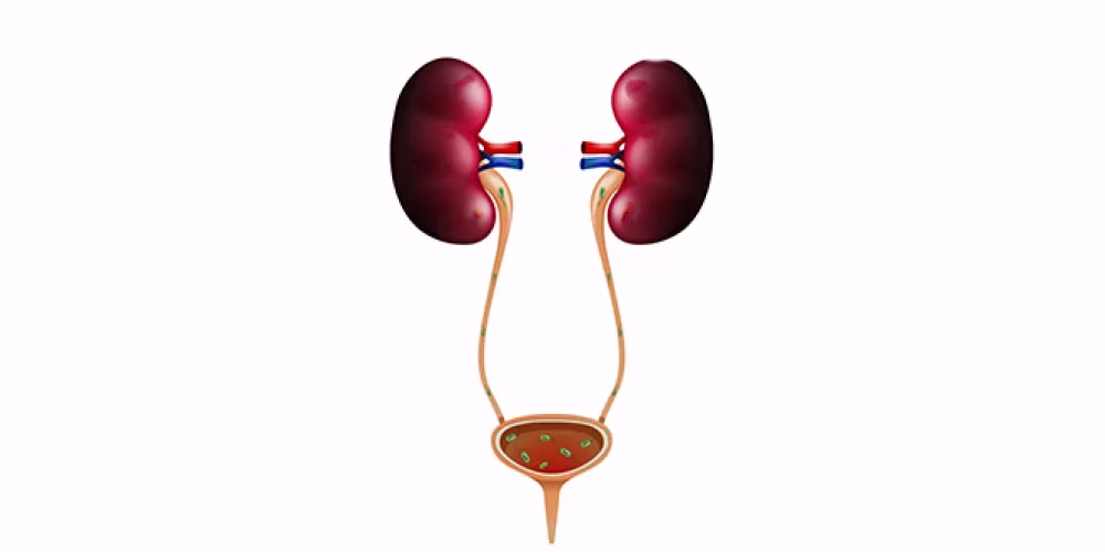 التهاب المسالك البولية وتأثيرها على التبول