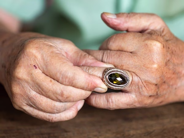 الاختلافات في تفسير الفضة بين المذاهب