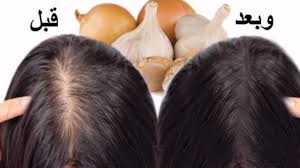 فوائد عصير البصل لتكثيف الشعر