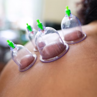 فوائد الحجامة للبشرة والشعر لدى النساء