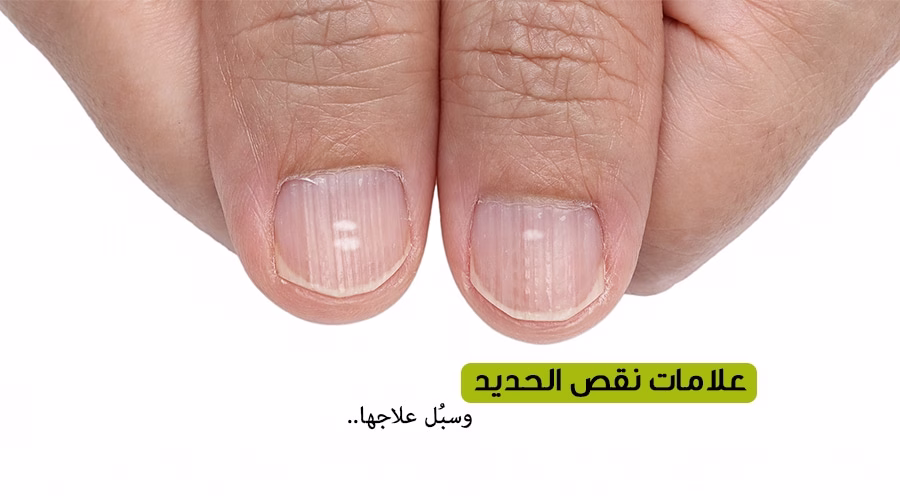 اعراض زيادة الحديد في الجسم