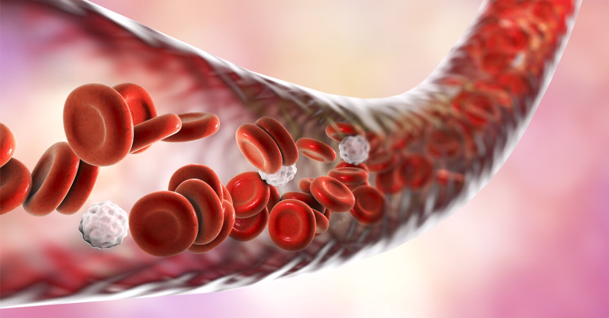سبب ارتفاع الصفائح الدموية