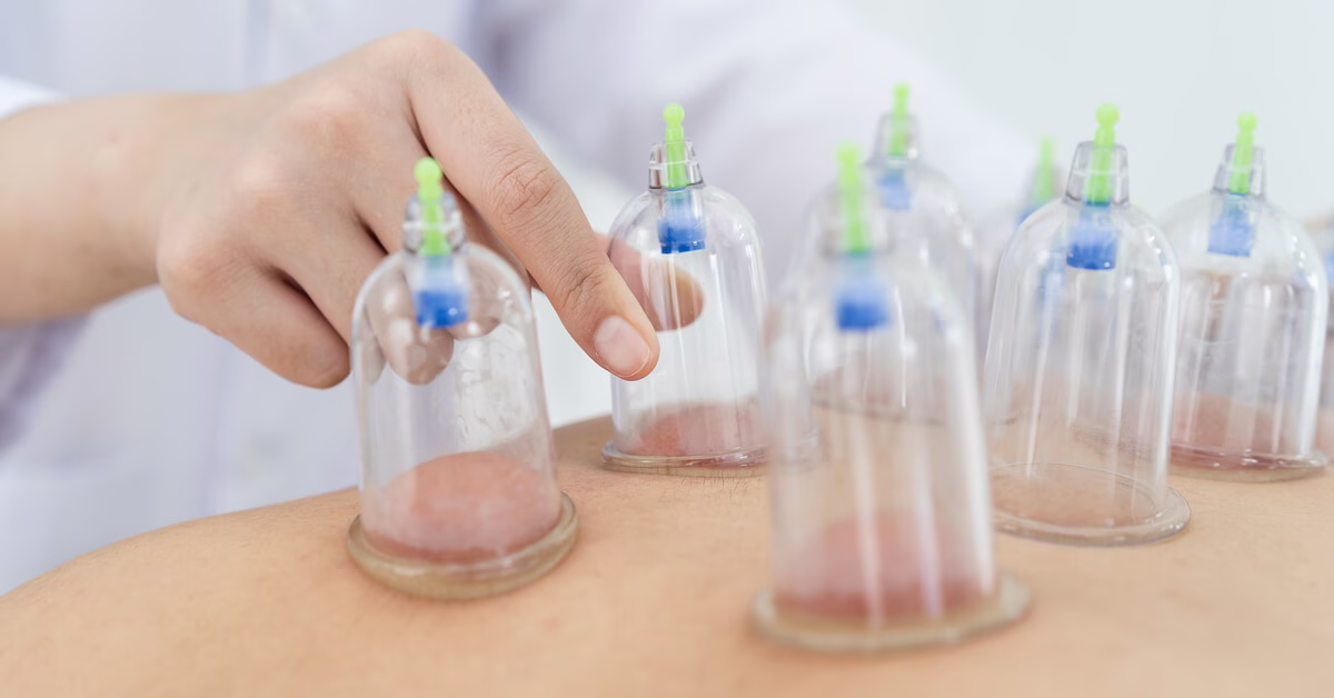 فوائد الحجامة للنساء