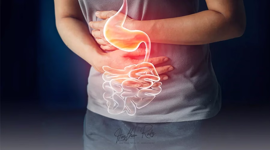 أنواع عسر الهضم ودرجاته