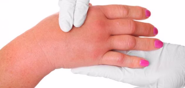 نظام غذائي متوازن للتحكم في الأملاح