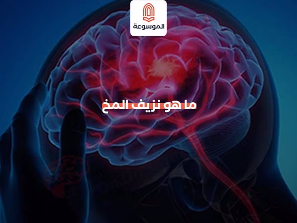 ما هو نزيف المخ